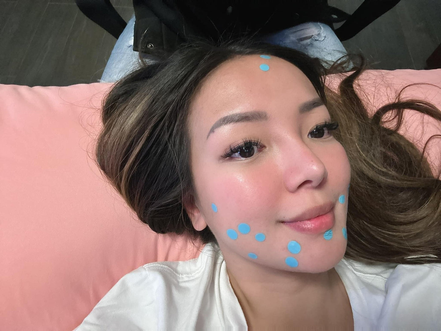 ROSMAR PIMPLE PATCH / ACNE PATCH