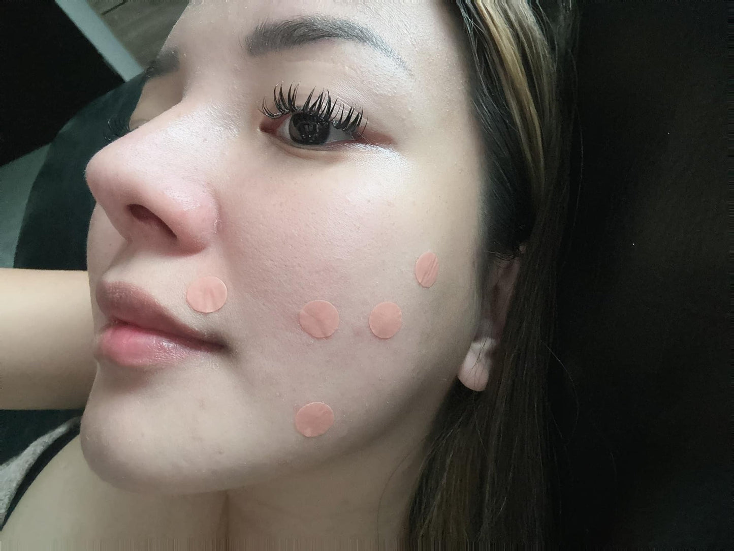 ROSMAR PIMPLE PATCH / ACNE PATCH