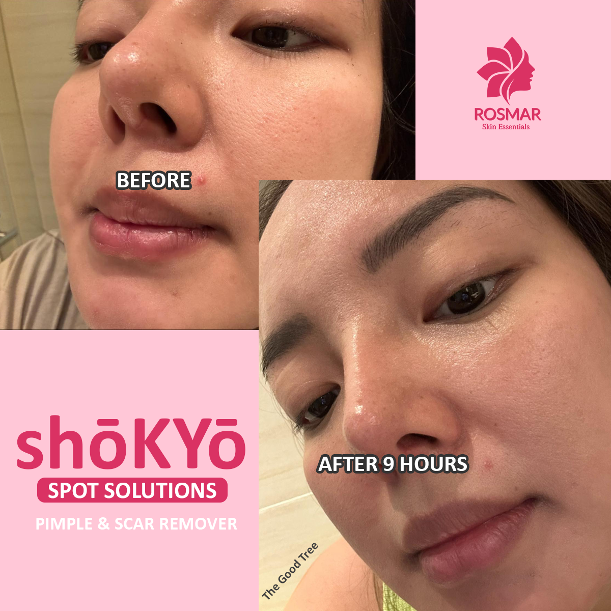 ROSMAR SHŌKYO SPOT SOLUTION
