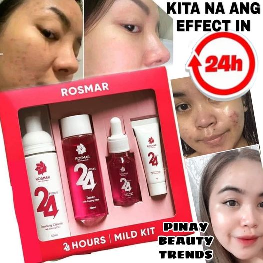 ROSMAR 24 HOURS MILD KIT | SAFE FOR TEENS, LACTATING, PREGNANT