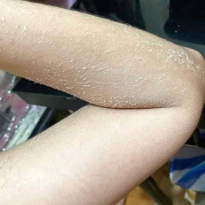 ROSMAR KOJICKU EXTREME EXFOLIATING SOAP